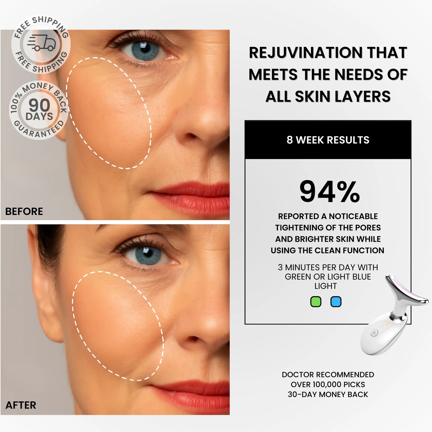 VitaLift Zaven Facial Sculptor